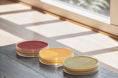 Three Petri dishes with different media